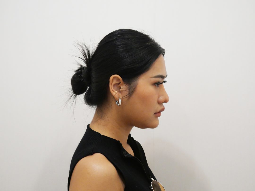 ตัดเหนียง Hers Clinic