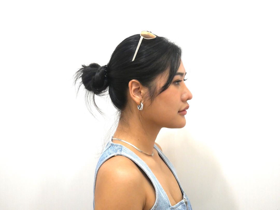 ตัดเหนียง Hers Clinic