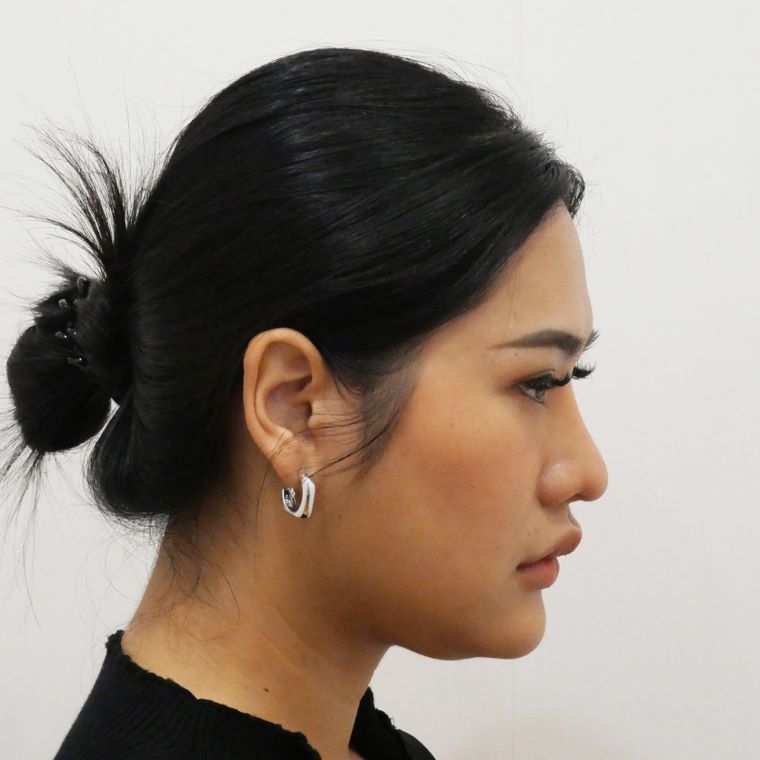 ตัดเหนียง Hers Clinic